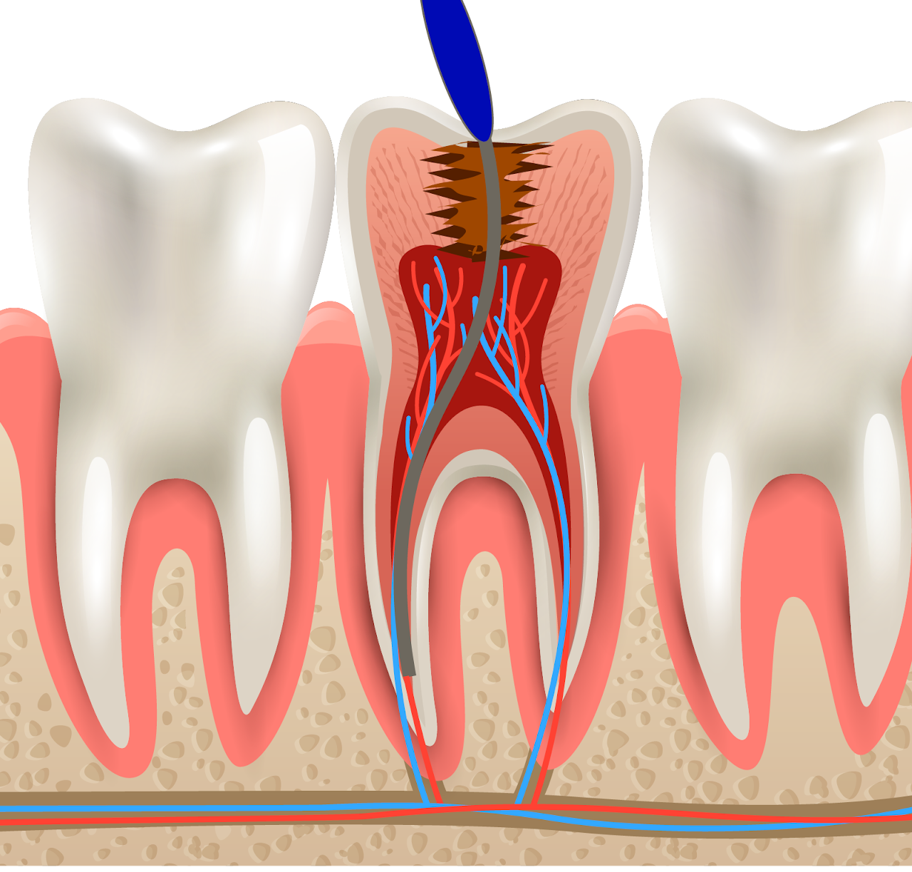 Endodoncia